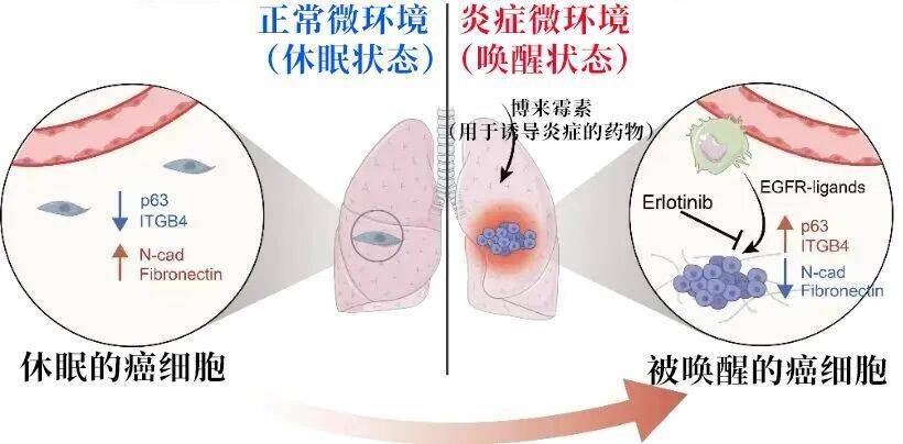 长期炎症会“唤醒”癌细胞！这份抗炎指南每个人都该看看