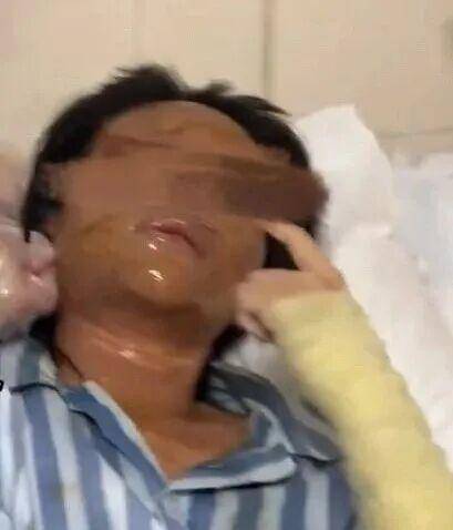 湖南一女主播被伪装的包裹炸伤，永州公安：正在核实具体情况